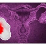 Nuevo leon y la licencia menstrual