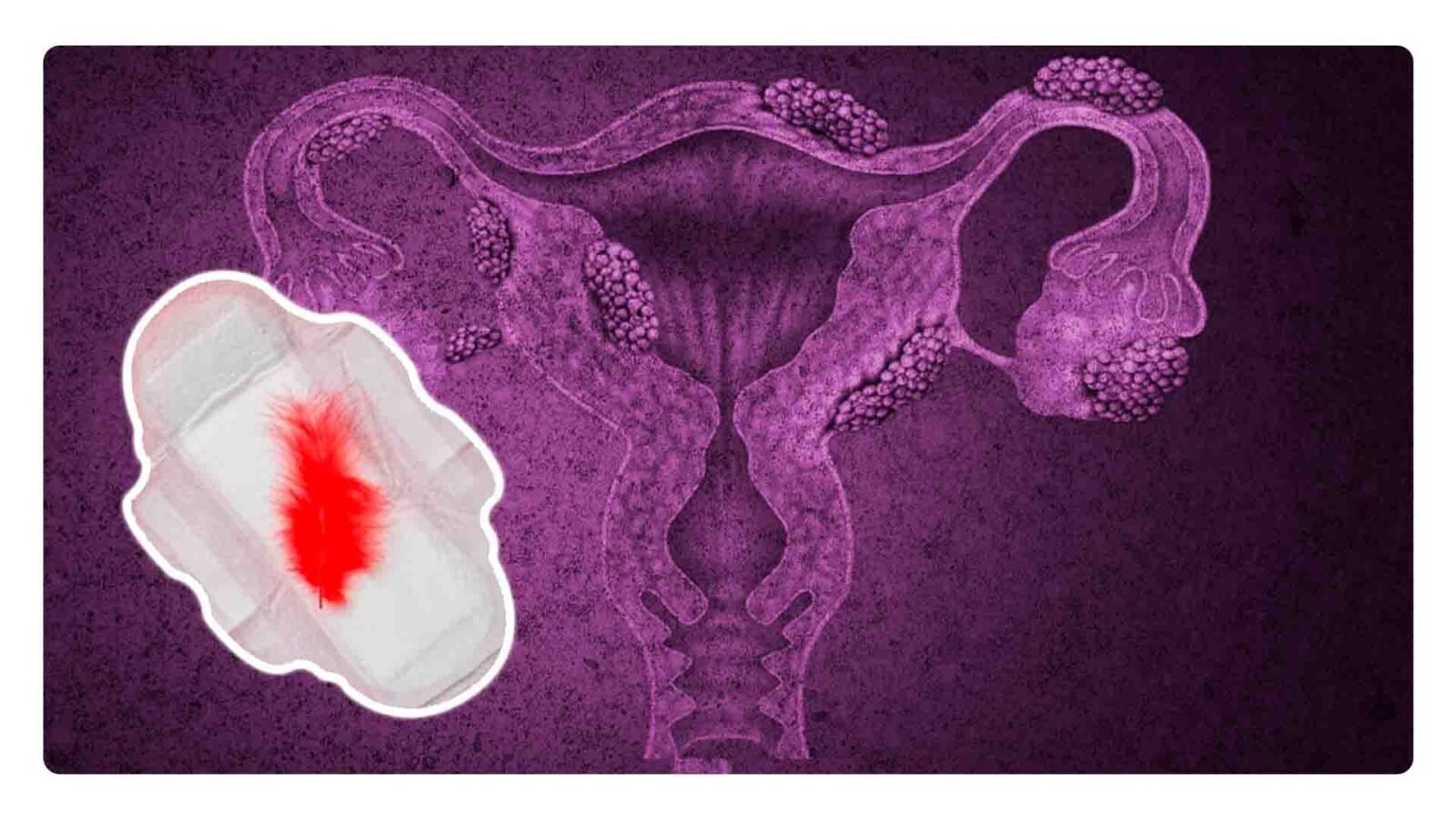 Nuevo leon y la licencia menstrual