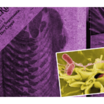 activan alerta por carne contaminada con salmonela en EU