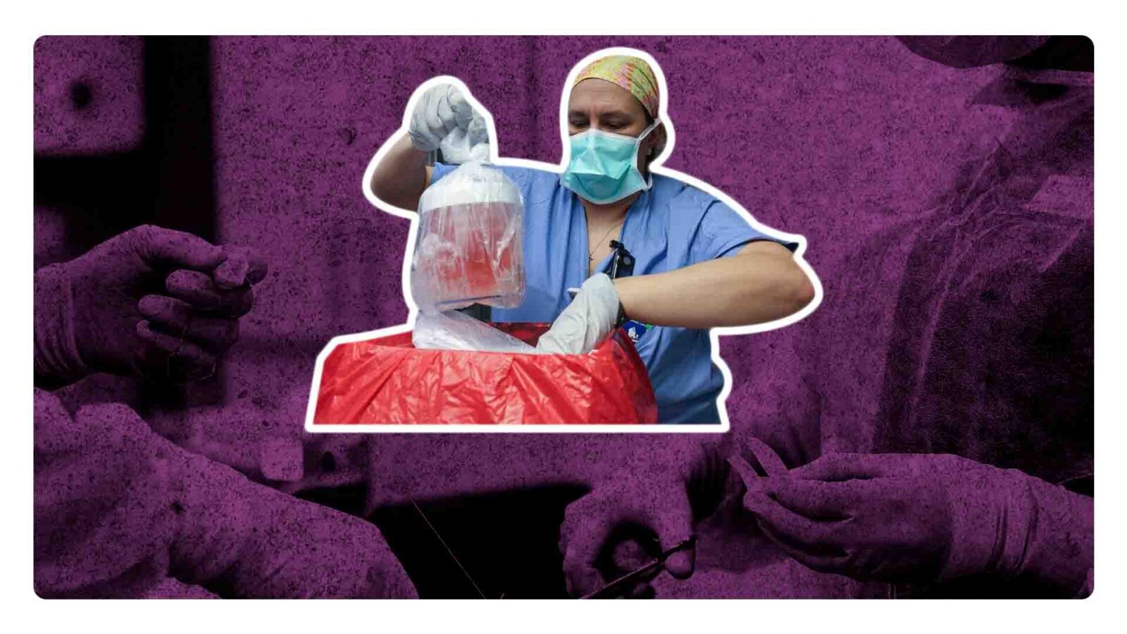 Exitoso el primer trasplante de riñón de un cerdo a una persona viva