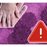 a que edad se debe poner la vacuna contra el sarampion