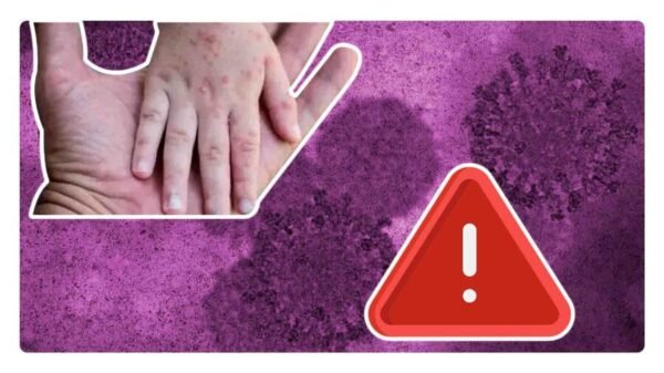 a que edad se debe poner la vacuna contra el sarampion