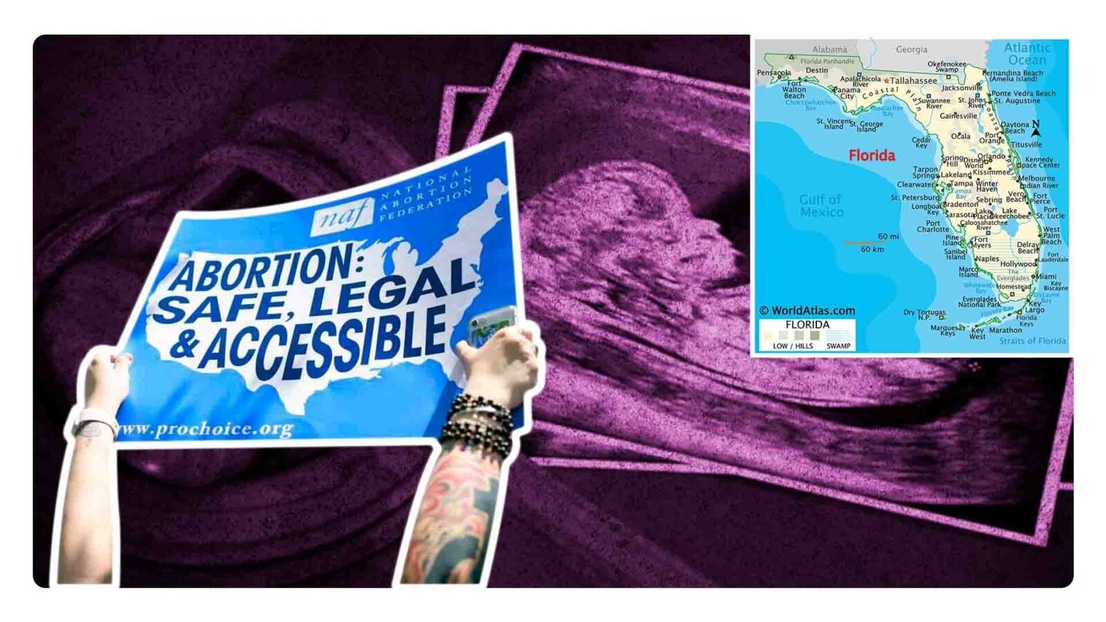 Ley antiaborto florida