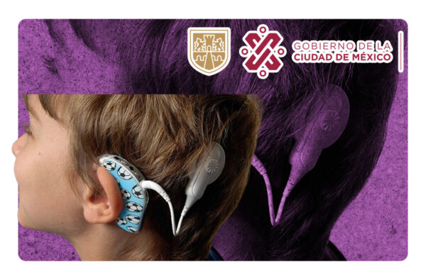 SEDIF Puebla entregó siete implantes cocleares a niñas y niños con problemas auditivos