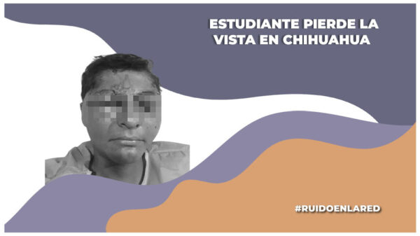 Estudiante pierde la vista por negligencia de su escuela