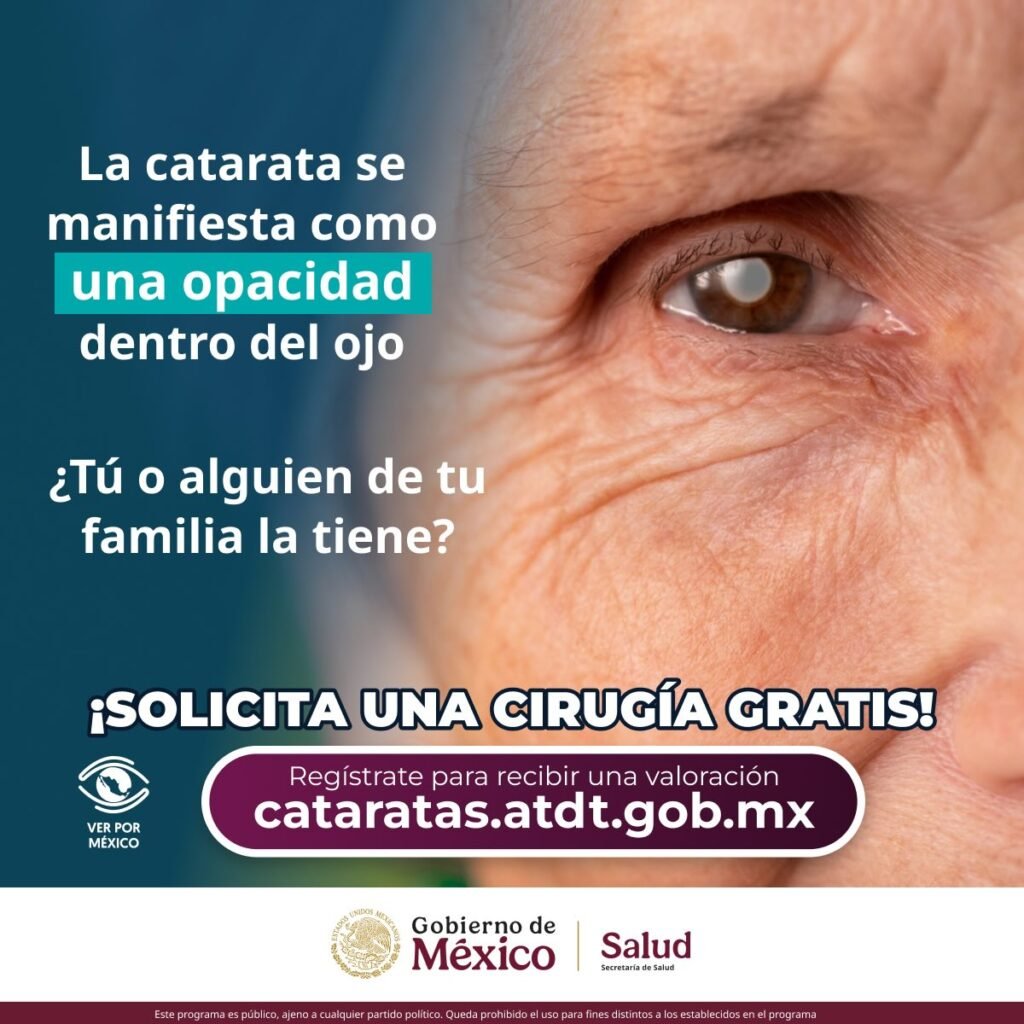 Imagen para nota de las operaciones gratis de cataratas del gobierno