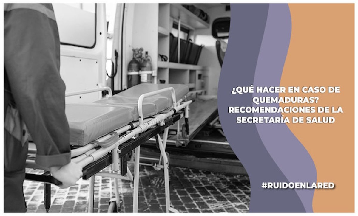 Imagen para nota de qué hacer en caso de quemaduras