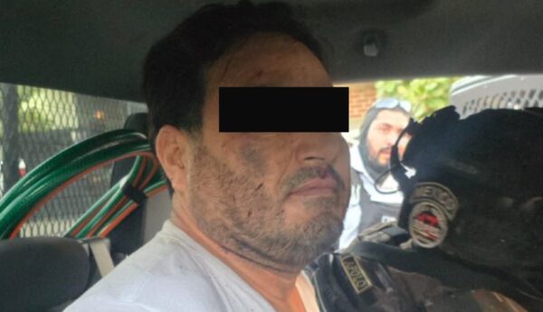 Carlos Alejandro Botox detenido