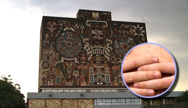 Caso de sarampión en la UNAM