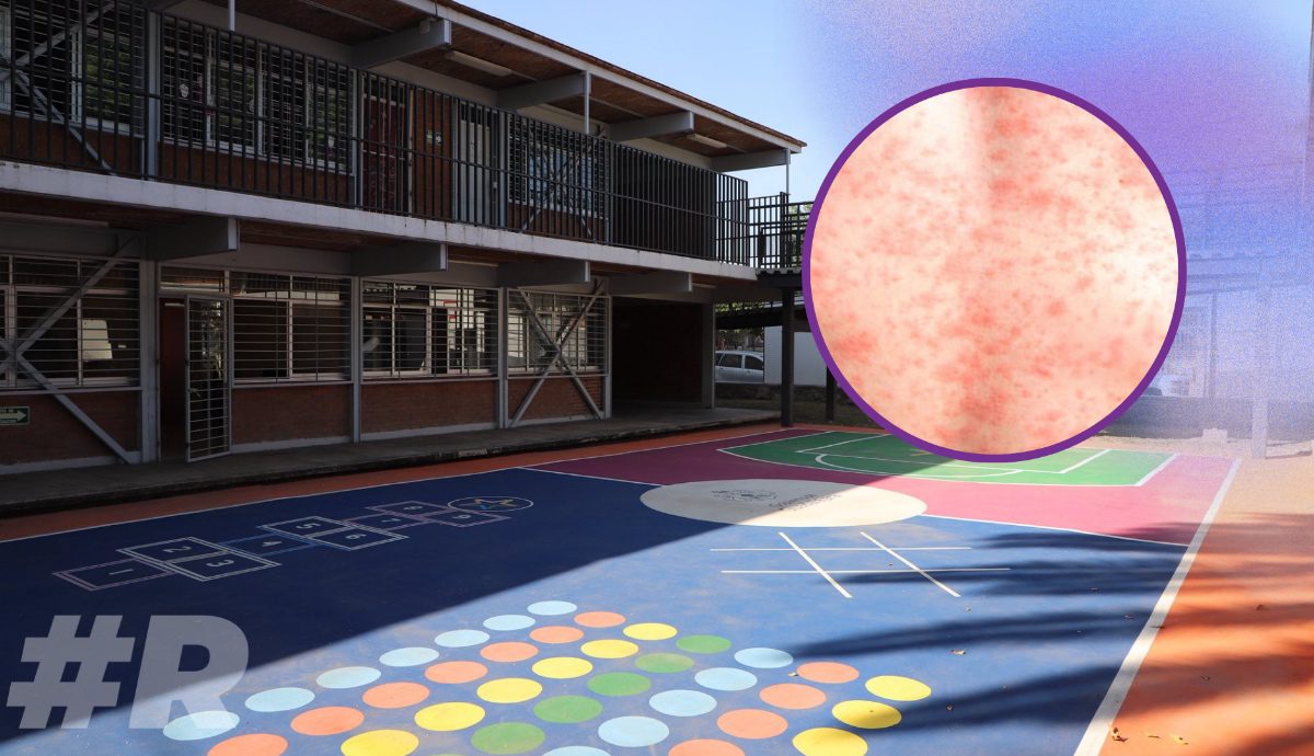 SEP Suspende clases en dos estados por brote de sarampión