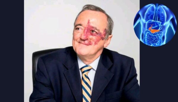 Mariano Barbacid, su investigacion es un avance en la cura contra el cáncer de páncreas