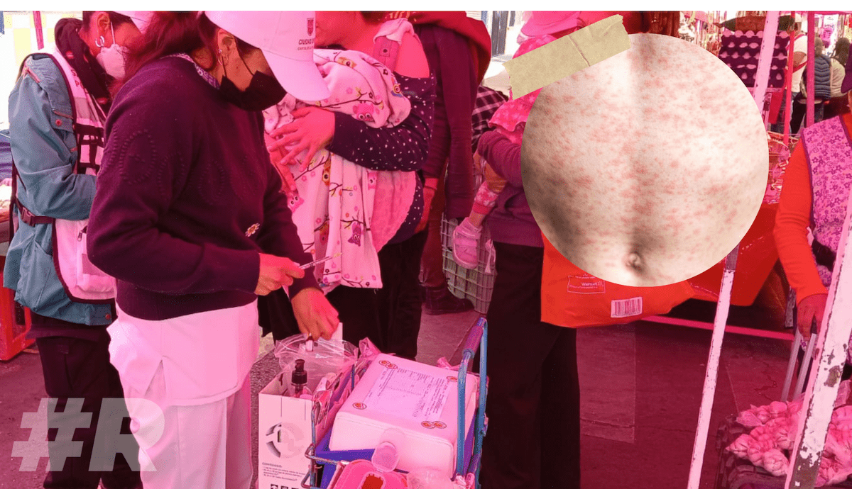 Primera muerte por sarampión en CDMX