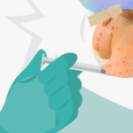 vacunación del sarampión en Iztapalapa