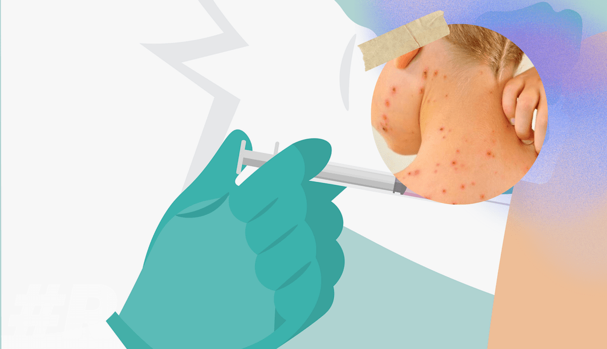 vacunación del sarampión en Iztapalapa