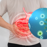 México emite alerta por brote de ciclosporosis